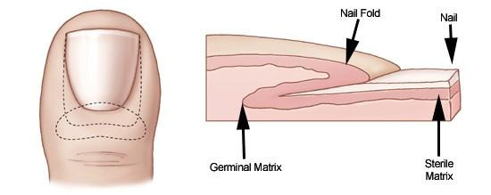 Toenail Ablation Surgery - Dr Greg Sterling Toenail Ablation Surgery - Dr Greg Sterling