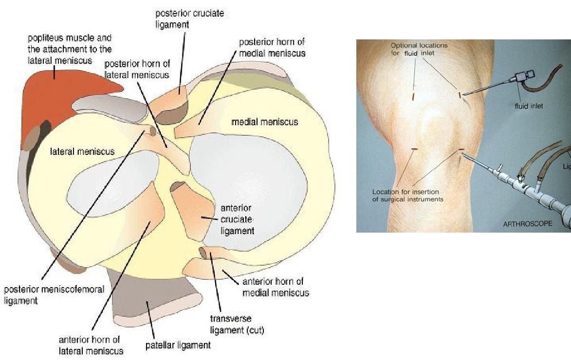 Microsoft Word - surgery_knee_arthroscopy.rtf