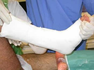 Microsoft Word - surgery_repair_ruptured_achilles.rtf