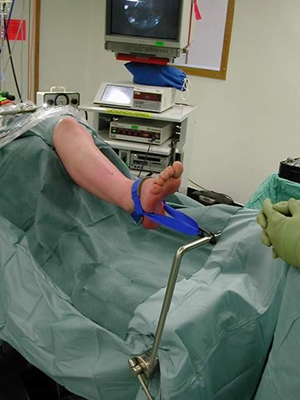 Microsoft Word - surgery_ankle_arthrodesis.rtf