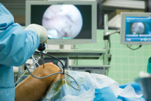 arthroscopy procedure being performed